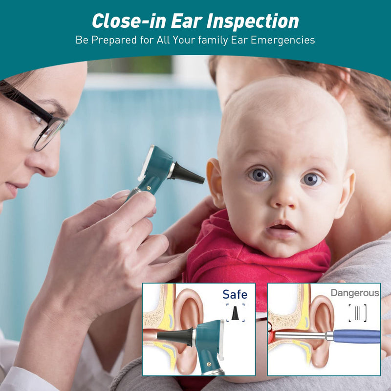 Scian Otoscope Kit - Ear Scope Otoscope with LED Light, 3x Magnification, 4 Speculum Tips Size, Lightweight Diagnostic Ear Care Tool for Children, Adults, Dogs, Home Use (Green) Green