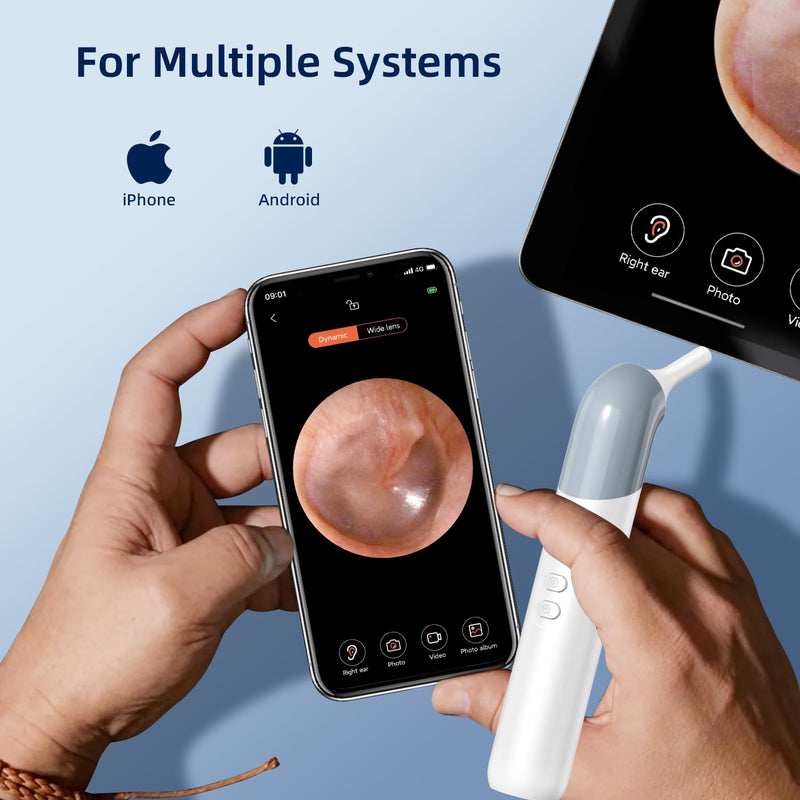 Qimic Wireless Otoscope Ear Camera - 1080P WiFi Otoscope with 6 LED Lights, Ear Scope Camera with 10 Colorful Accessories for Kids,Pets &Adults,Support Photo and Video, Compatible with Android Q09