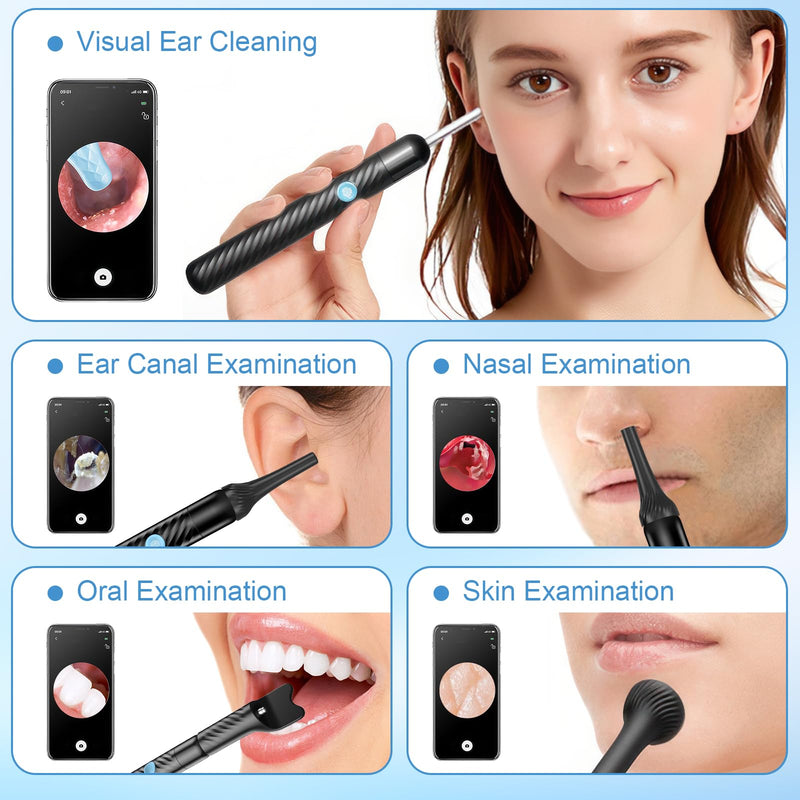 Euakee 4 in 1 Ear Wax Remover Otoscope, 1080P WiFi IP67 Waterproof Ear Cleaner for Adults Children, for Ear Canal, Nose, Mouth and Skin Examination, Ear Cleaner for iOS, Android 03