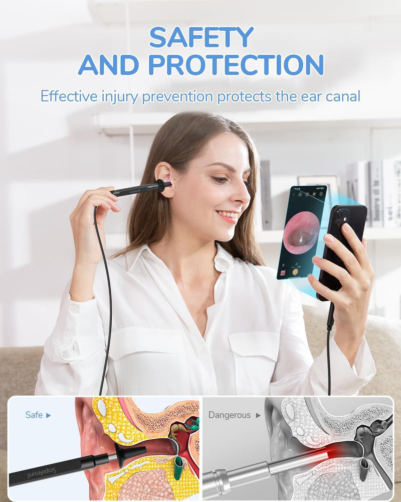 [AUSTRALIA] - ScopeAround Otoscope with Light, 1080P FHD Ear Scope, 3.9mm Digital Otoscope Camera with 6 LED Lights Ear Wax Removal Tool Camera, Ear Scope with Light, Compatible with USB-C 