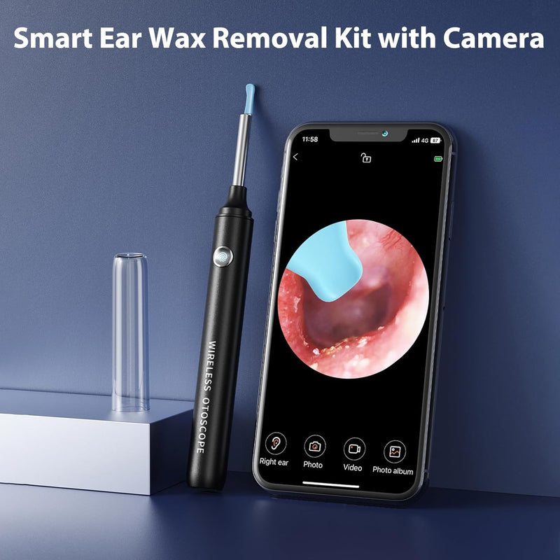 Qimic Ear Cleaner, Ear Wax Remover, 1080P Otoscope with Light, Ear Cleaner for Adults, Ear Wash, Ear Wash System, Ear Cleaning Set with 10 Ear Tips and Water Catching Basin blue-black