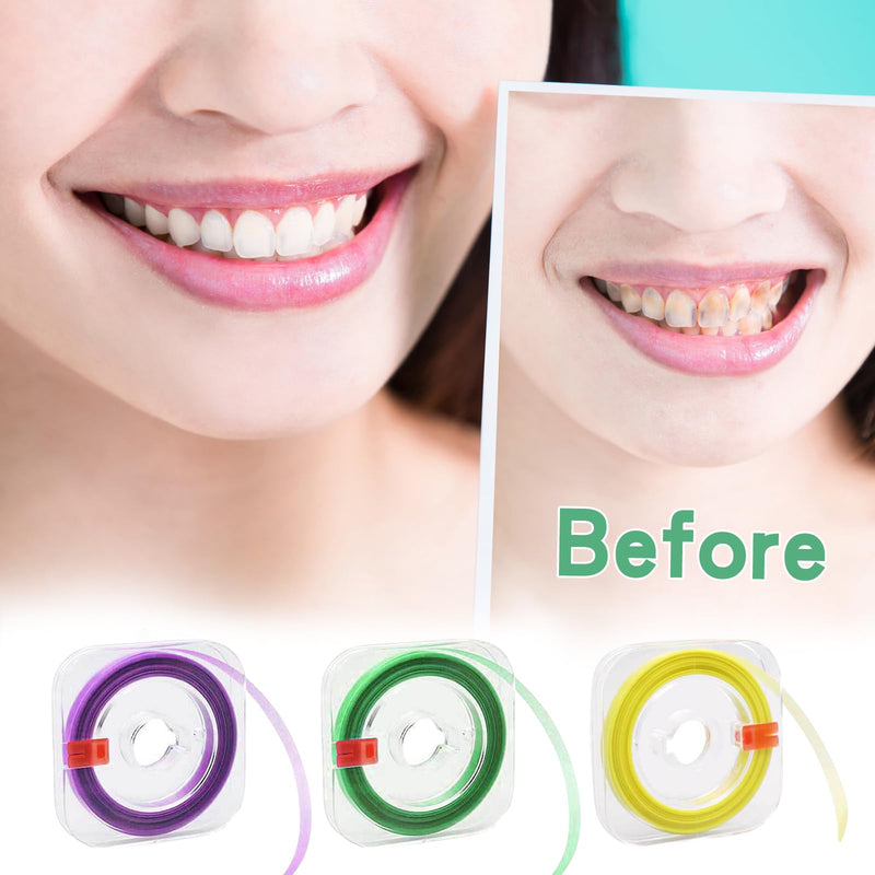 Zimoer Tooth Sandpaper, 3 Volumes Dental Polishing Strips, 20/30/50μm Size of Grains, Teeth Sandpaper for Spaces, Interdental Sanding Tools for Polishing Teeth, 4 mm x 6 m / Rolls