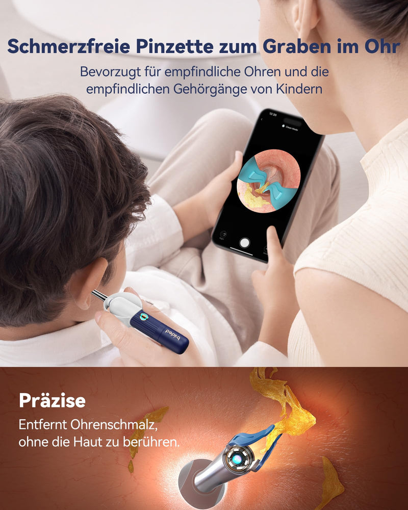 Ear Wax Remover Otoscope: 1920P HD WiFi Flexible Ear Cleaner with Camera - 2025 New 360° Wide Angle Ear Cleaner with Light for Ears/Nose/Neck Examinations Otoscope for Adults Children