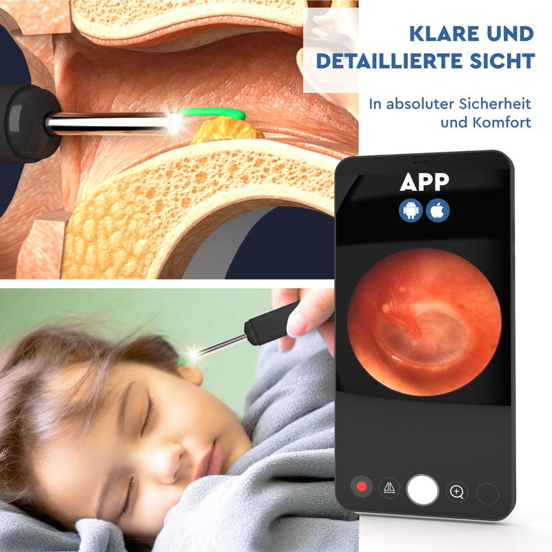 Ear Wax Remover Otoscope with Camera 1920p 3.6 mm WiFi Ear Cleaner - UdiGuard Ear Mirror Ear with 6 LED Lights Adults Rabbits and Children Black - Compatible with iPhone iPad Android Udiguard Black Otoscope