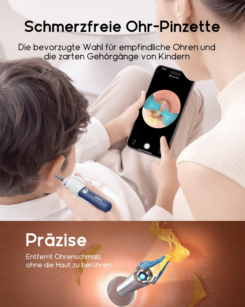 Bebird Ear Wax Remover Otoscope, 1920P HD Flexible Ear Cleaner Camera with Tweezers, Ear Cleaner Camera with Replacement Tips for Ears/Nose/Neck Examinations, Otoscope Ear for Adults, Children Blue