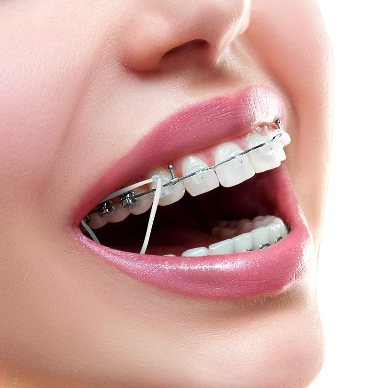 [AUSTRALIA] - Annhua Dental Braces with 5 Placements, 500 Pieces Braces Orthodontic Elastic Rubber Bands for Braces, Gap Teeth, Crooked Teeth, etc. (Rabbit 3/16 Inch 3.5 oz) Rabbit 3/16" 3.5oz 