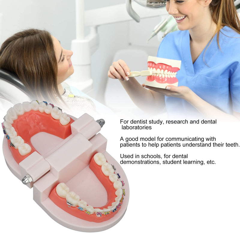 Tooth Demonstration Model, Teeth Dental Demonstration Model, Dental Typodont Teeth Model with Orthodontic Metal Clamp for Dentist Teaching Research Dental
