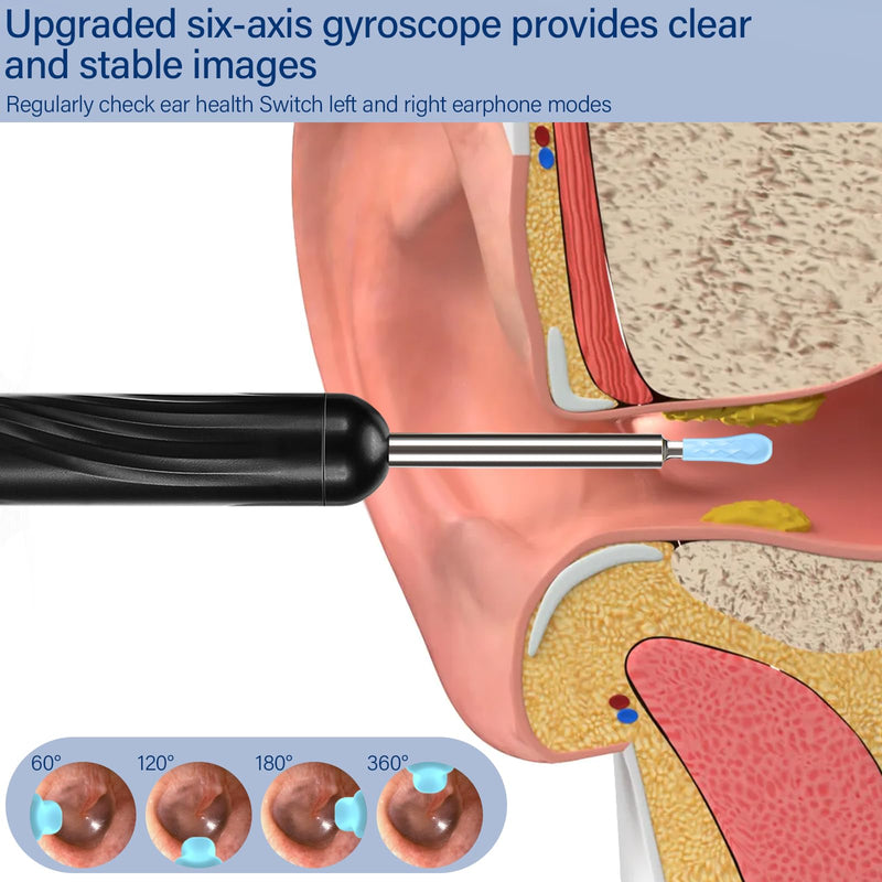 Pavlleen Ear Wax Remover Otoscope, with 6 LEDs and 3.5 mm Lens, IP67 Waterproof Otoscope, 360° Wide Angle Otoscope Camer, WiFi Ear Cleaner, Ear Cleaning for iPhone, iPad and Android Smartphones