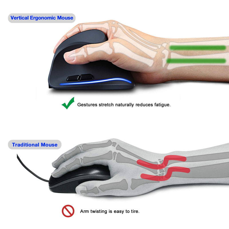 TRELC Ergonomic Mouse, 2.4G Wireless Vertical Optical Mouse with Adjustable Sensitivity (1000/1600/2400 DPI), 6 Buttons for PC, Desktop, Laptop, Notebook (Black) 2.4GHz