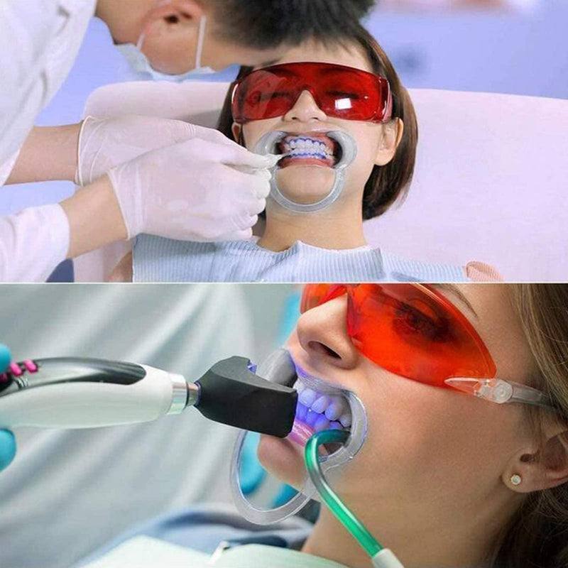 C-Shape Mouth Opener Mouth Lip Opener Mouth Separator Cheek Holder Intraoral Lips Mouth Opener C Shape Cheek Retractor Tools for Mouth Opener Challenge for Dental Care and Party Game Pack of 10