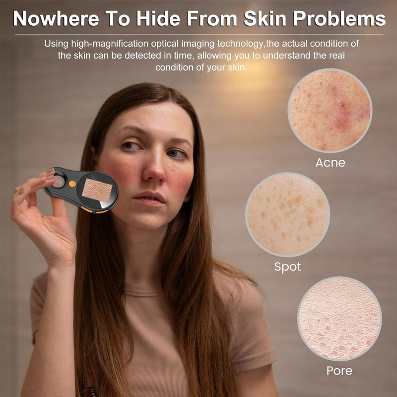 [AUSTRALIA] - Handheld Dermatoscope Skin Analyzer Machine, Wireless Portable Digital Microscope with 1080P IPS Screen 8 LEDs, 500X Magnifier, for Scalp/Hair Trichomes Facial Skin Dermatoscope Black-Dual Mirror 