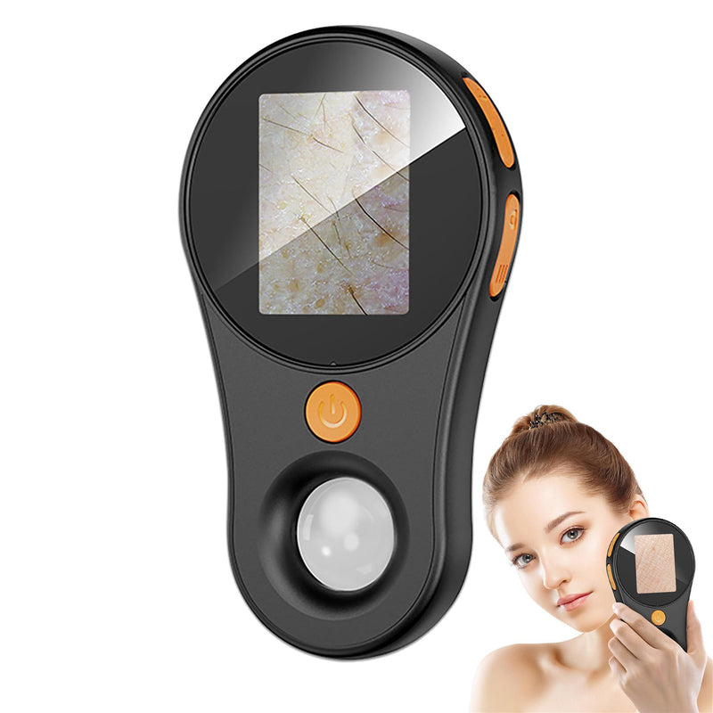 [AUSTRALIA] - Handheld Dermatoscope Skin Analyzer Machine, Wireless Portable Digital Microscope with 1080P IPS Screen 8 LEDs, 500X Magnifier, for Scalp/Hair Trichomes Facial Skin Dermatoscope Black-Dual Mirror 