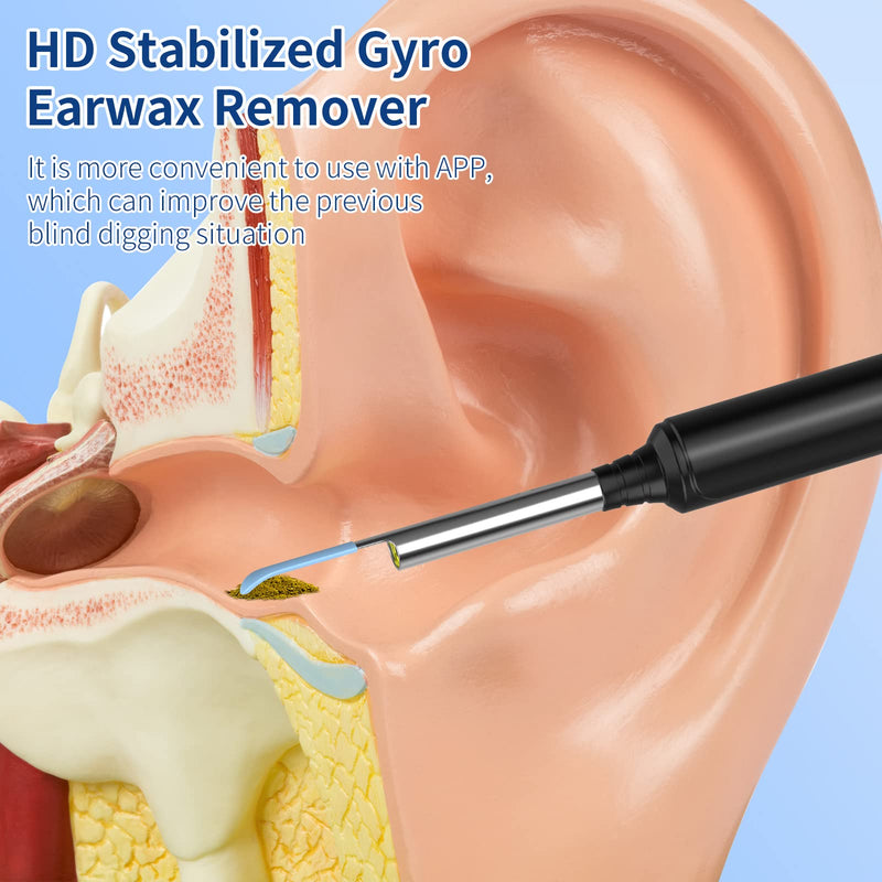 [AUSTRALIA] - Earwax Remover Otoscope, VITCOCO WiFi Ear Cleaner Camera 5MP HD Ear Camera IP67 Waterproof Ear Mirror 3.5 mm Lens Ear Endoscope with 6 LEDs for iPhone, iPad and Android Smartphones (Black) Black 