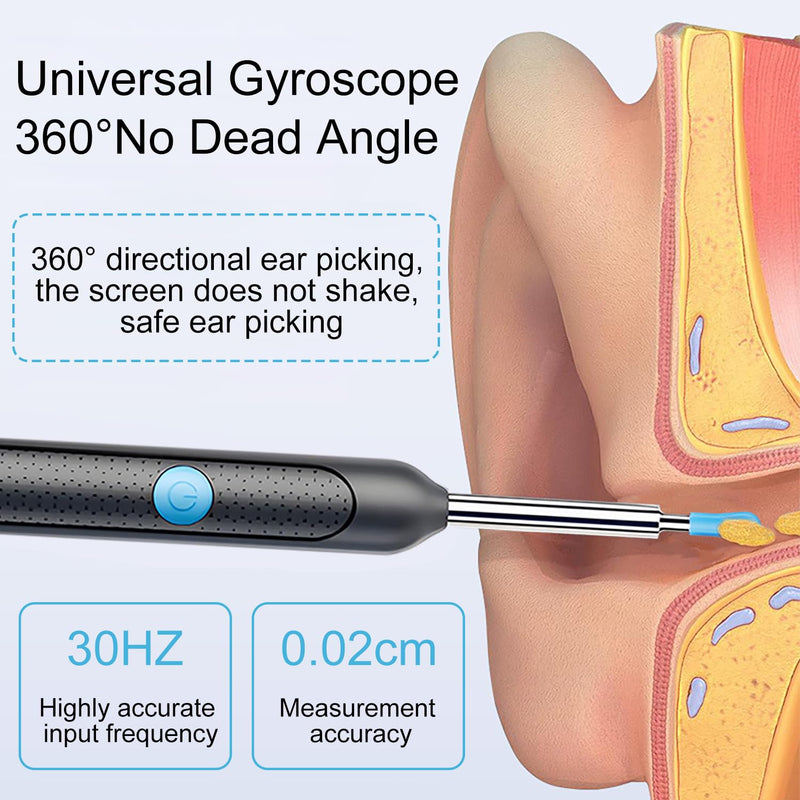 liuchanghe Ear Wax Remover Otoscope, 1920P WiFi Ear Cleaner, IP67 Waterproof Otoscope Ear, 360° Wide Angle Otoscope Camera with 6 LEDs for iPhone, iPad and Android Smartphones (Black)