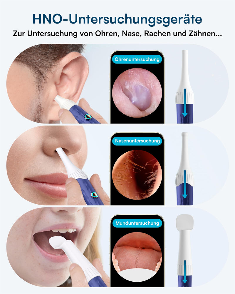 BEBIRD Earsight Plus D39R Ear Wax Remover Otoscope, 1920P HD Flexible Ear Cleaner Camera with Tweezers, Ear Cleaner Camera for Ear/Nose/Neck Examinations (Blue) Blue