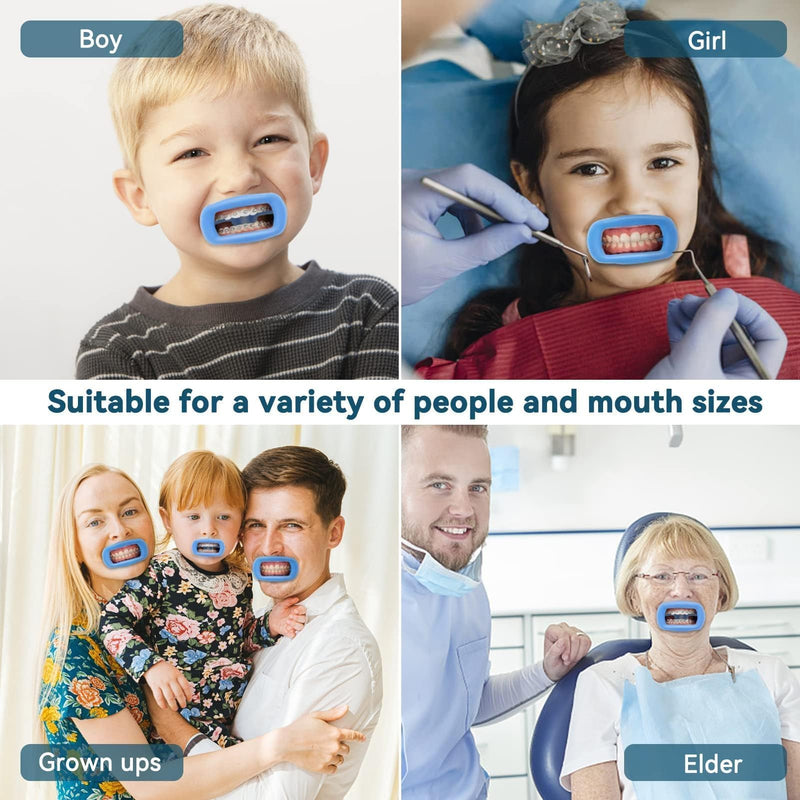 [AUSTRALIA] - 2 Pieces Dental Mouth Openers Reusable Autoclavable Silicone Teeth Whitening Cheek Holder Lip Holder for Dentist Mouth Inspection Mouth Guard Challenge Game (Blue) blue 