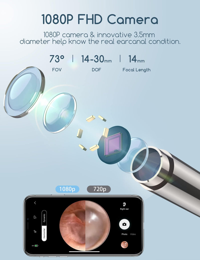 Earwax Remover Otoscope, Qimic WiFi Ear Cleaner, 1080P Ultra Thin HD Wireless Waterproof Ear Mirror with 3.5 mm Lens and 6 LEDs for iPhone, iPad and Android Smartphones Black