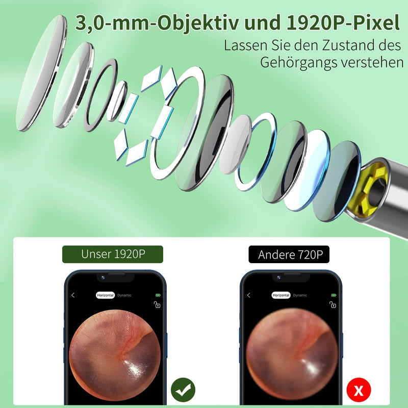 [AUSTRALIA] - Earwax Remover Otoscope, VITCOCO 1920P Wifi Ear Cleaner, Ear Cleaner with Camera, Otoscope with 6 LEDs for iPhone, iPad and Android Smartphones, White 