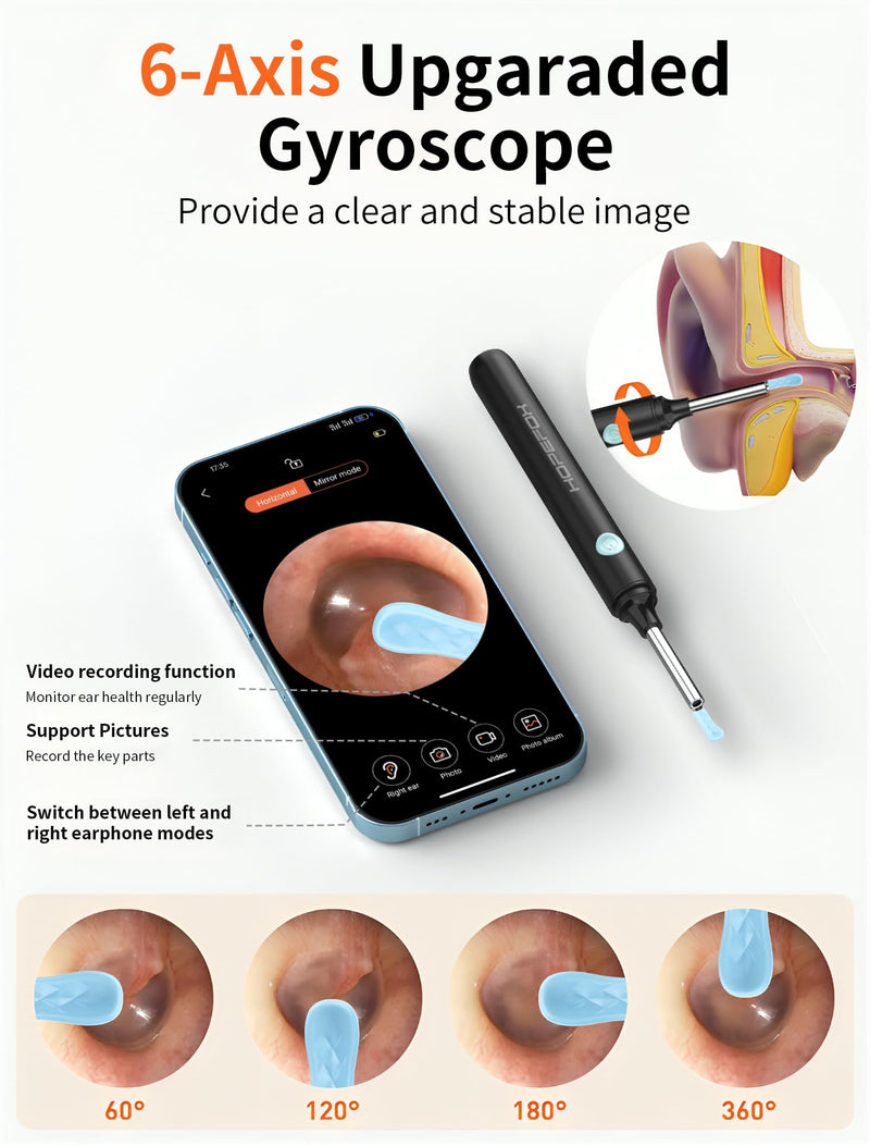 Hopefox Ear Wax Remover Otoscope, 1080P HD WiFi Ear Cleaner with Camera and 6 LEDs Lights, Ear Cleaning for Baby, Children, Adults 2-Black