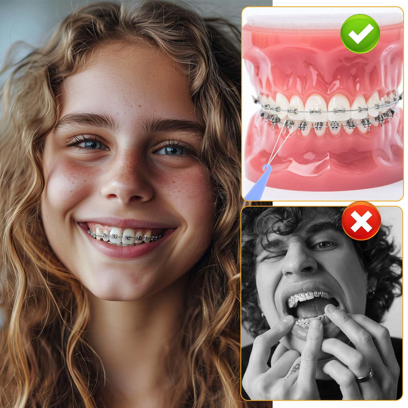 Orthodontic Rubber Bands 3/16