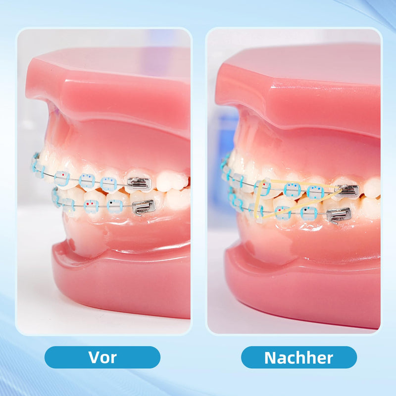 [AUSTRALIA] - Annhua Dental Braces with 5 Placements, 500 Pieces Braces Orthodontic Elastic Rubber Bands for Braces, Gap Teeth, Crooked Teeth, etc. (Rabbit 3/16 Inch 3.5 oz) Rabbit 3/16" 3.5oz 