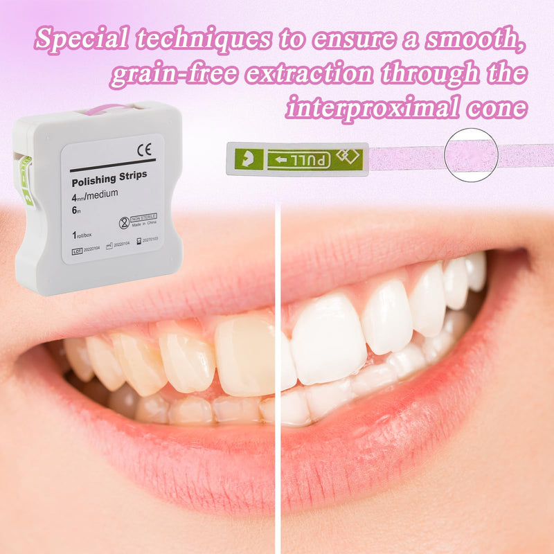 Tooth Sandpaper, Portable Tooth Sandpaper, 4 mm Width, 6 m/Rolls/Box, Polishing Strips, Interdental Sandpaper, Interdental Sanding Tools for Polishing Teeth (Pink)