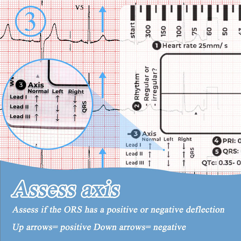 SNONESIY ECG 7 Step Ruler, Transparent ECG Calipers Meter, Plastic, 9 x 6.5 cm