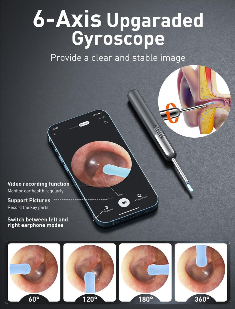Qimic Ear Wax Remover Otoscope, WiFi Ear Cleaner with Camera, IP67 Waterproof Ear Camera, 360° Wide Angle Otoscope Camera with 6 LEDs for iPhone, Android Smartphones and iPad N5D 2-Black Grey