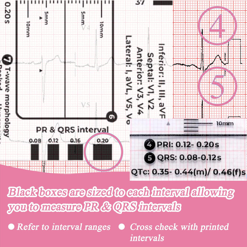 [AUSTRALIA] - Ecg 7 Step Ruler, Ecg/Ekg 7 Step Ruler Card, Portable Ecg Ruler Plastic Ruler Measuring Tool, Provides Data Support, Wear-resistant and Durable, Suitable for Doctors, Medical Students, etc. 