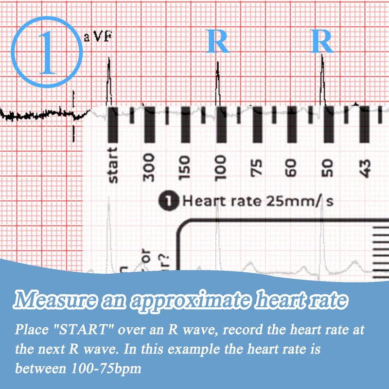 SNONESIY ECG 7 Step Ruler, Transparent ECG Calipers Meter, Plastic, 9 x 6.5 cm