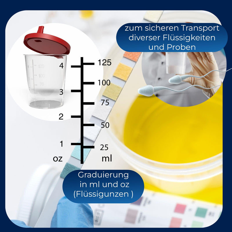 Horn Medical Urine Cup / Sample Cup with Snap Closure 150 ml Capacity, Size Chart up to 125 ml/4 oz, Can Be Written On (25) 25