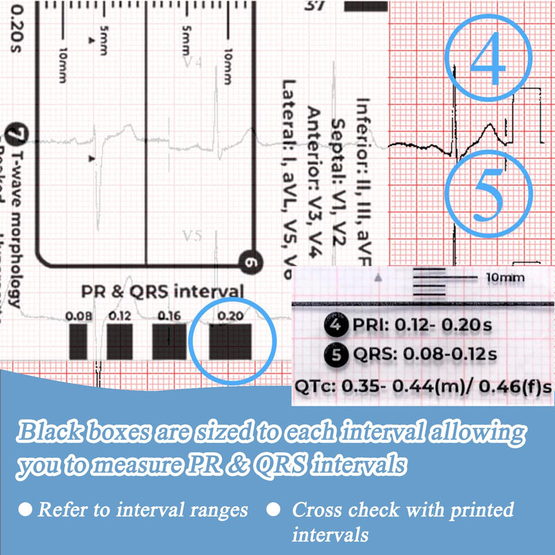 SNONESIY ECG 7 Step Ruler, Transparent ECG Calipers Meter, Plastic, 9 x 6.5 cm