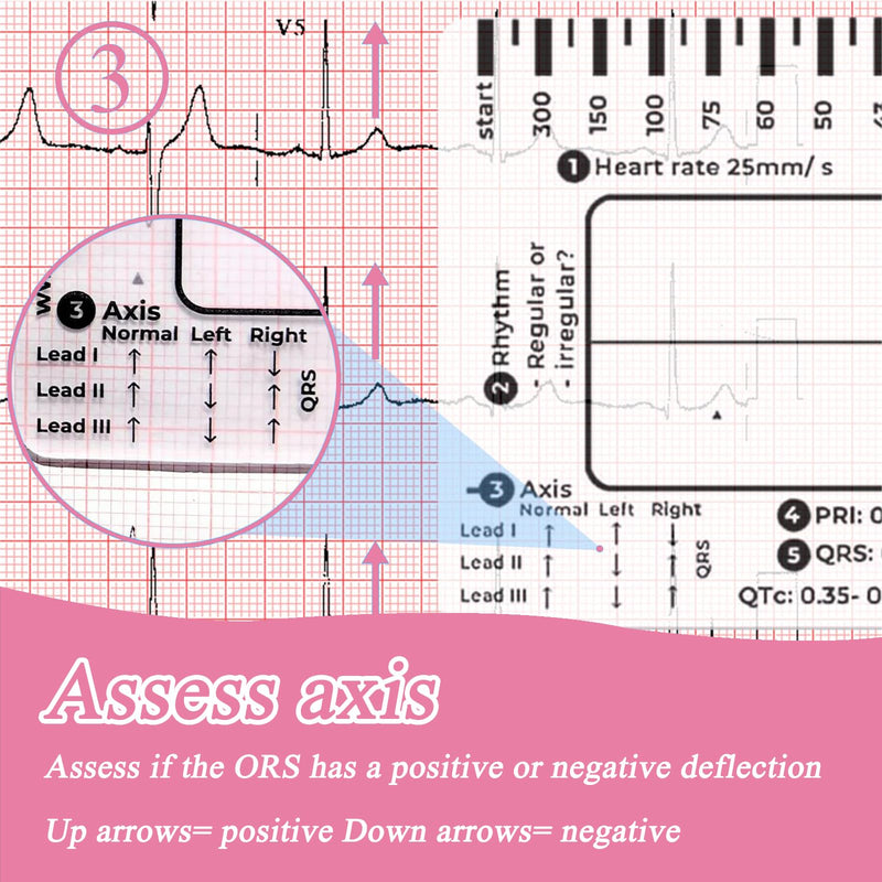 [AUSTRALIA] - Ecg 7 Step Ruler, Ecg/Ekg 7 Step Ruler Card, Portable Ecg Ruler Plastic Ruler Measuring Tool, Provides Data Support, Wear-resistant and Durable, Suitable for Doctors, Medical Students, etc. 