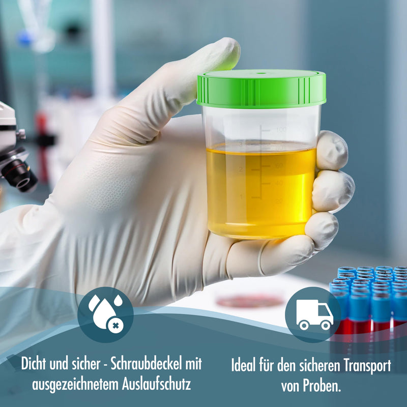 Theracaso Sample Cup Set - 10 Pieces of 125 ml - Includes 40 Labels - Leak-proof Urine Cups with Screw Lid Graduated up to 100 ml - For Kitchen, Crafts, Medicine, Urine Samples - Can Be Written On