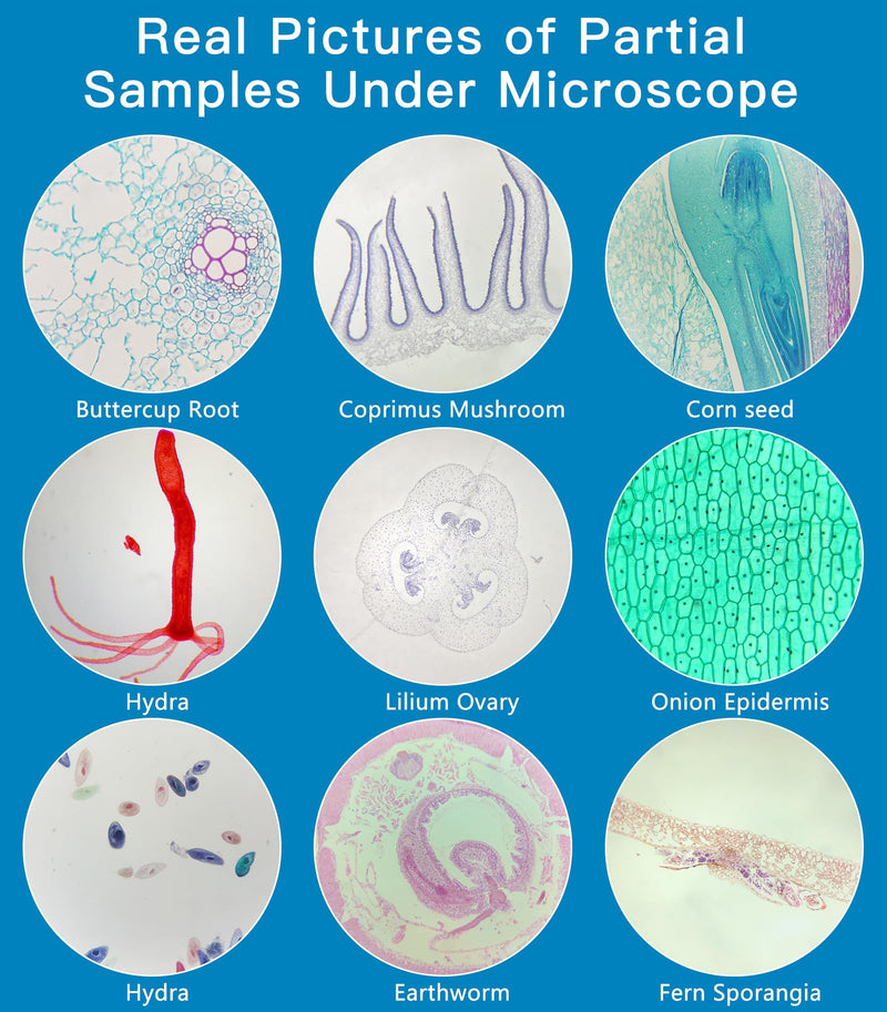 [AUSTRALIA] - Microscope Slides with Specimens for Kids, 60 Lab-Grade Prepared Microscope Slides, Animal/Plant/Microbe/Tissue Samples, STEM Biology Kit for Homeschool, Classroom Labs & Science Education Ages 8+ 