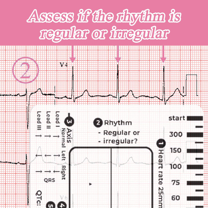 [AUSTRALIA] - Ecg 7 Step Ruler, Ecg/Ekg 7 Step Ruler Card, Portable Ecg Ruler Plastic Ruler Measuring Tool, Provides Data Support, Wear-resistant and Durable, Suitable for Doctors, Medical Students, etc. 