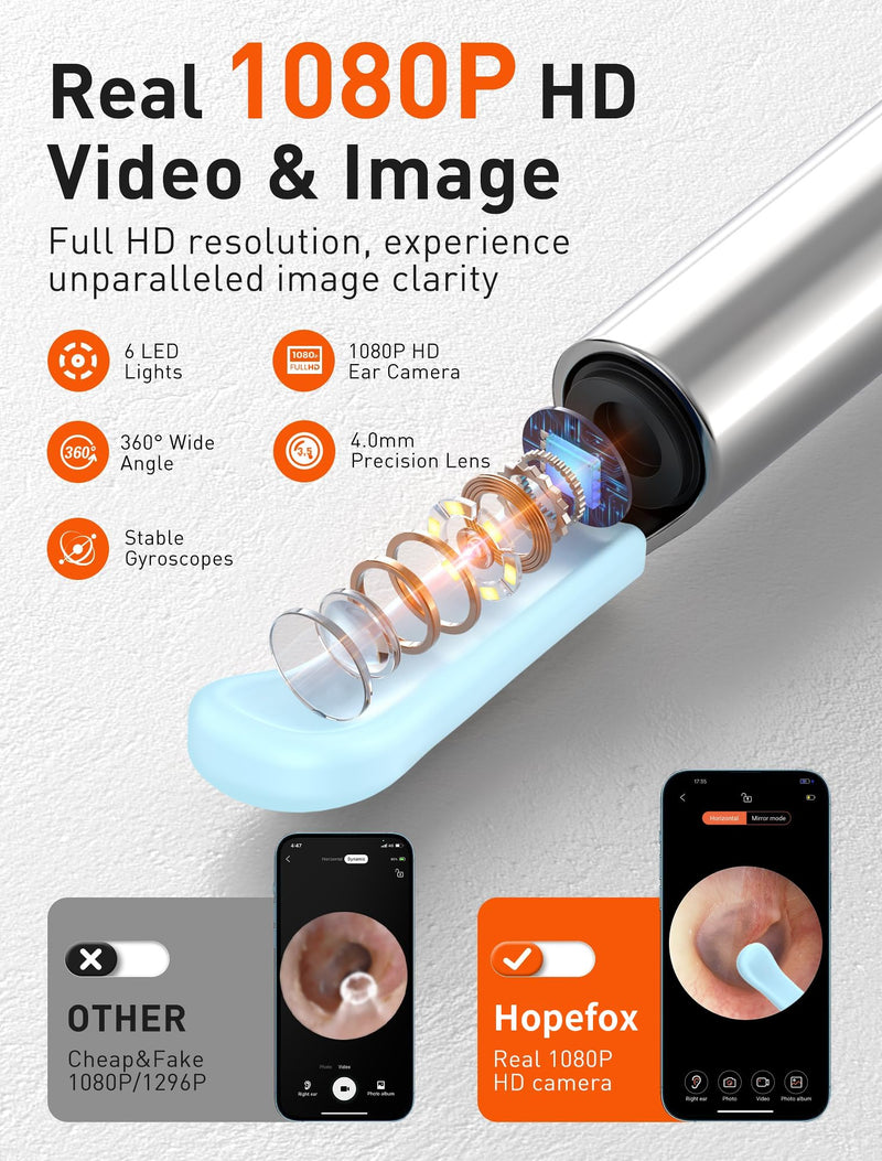 Hopefox Ear Wax Remover Otoscope, 1080P HD WiFi Ear Cleaner with Camera and 6 LEDs Lights, Ear Cleaning for Baby, Children, Adults 2-Black