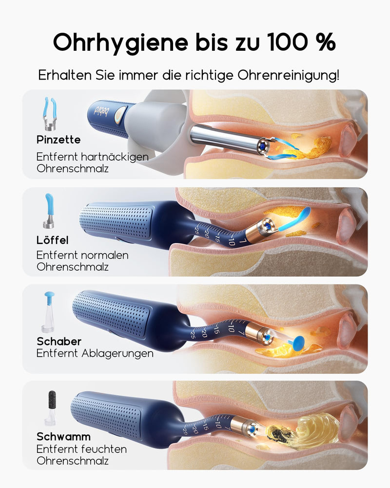 Bebird Ear Wax Remover Otoscope, 1920P HD Flexible Ear Cleaner Camera with Tweezers, Ear Cleaner Camera with Replacement Tips for Ears/Nose/Neck Examinations, Otoscope Ear for Adults, Children Blue