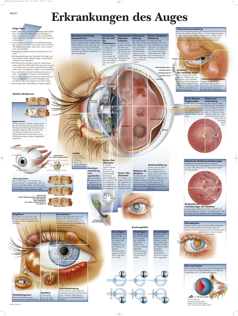 [AUSTRALIA] - 3B Scientific Clay Trafel – Diseases of the Eye, VR0231UU Paper 