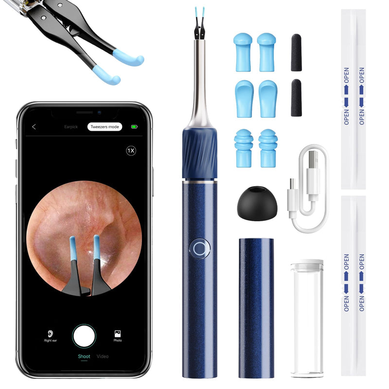 Qimic Ear Wax Remover Otoscope, 1080P HD WiFi Ear Cleaner, Ear Camera with Tweezers & 4 LEDs, Otoscope for iOS & Android, IP67 Waterproof Ear Cleaner for Adults, Children and Pets S8 blue