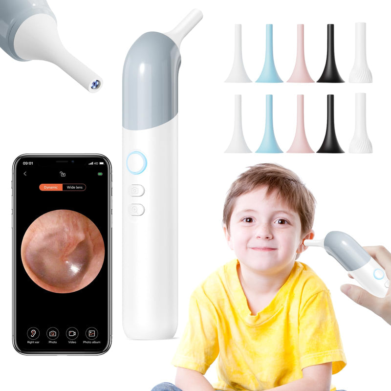 Qimic Wireless Otoscope Ear Camera - 1080P WiFi Otoscope with 6 LED Lights, Ear Scope Camera with 10 Colorful Accessories for Kids,Pets &Adults,Support Photo and Video, Compatible with Android Q09