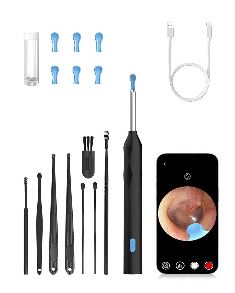 Ear Wax Remover Otoscope, WiFi 1080P HD Ear Cleaner, 360° Wide Angle Otoscope Camera for Otoscope IP67 Waterproof Otoscope Ear for Phone (Black) Black