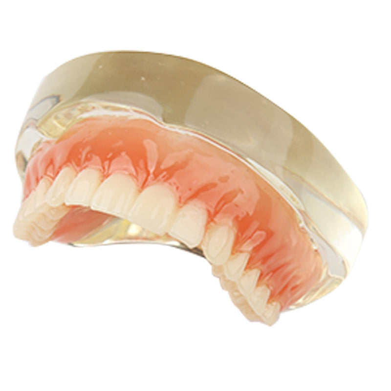 Dental Model Upper Jaw Deck Prosthesis with 2 Implants for Training and Study (Upper Jaw)