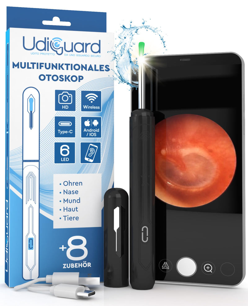 Ear Wax Remover Otoscope with Camera 1920p 3.6 mm WiFi Ear Cleaner - UdiGuard Ear Mirror Ear with 6 LED Lights Adults Rabbits and Children Black - Compatible with iPhone iPad Android Udiguard Black Otoscope