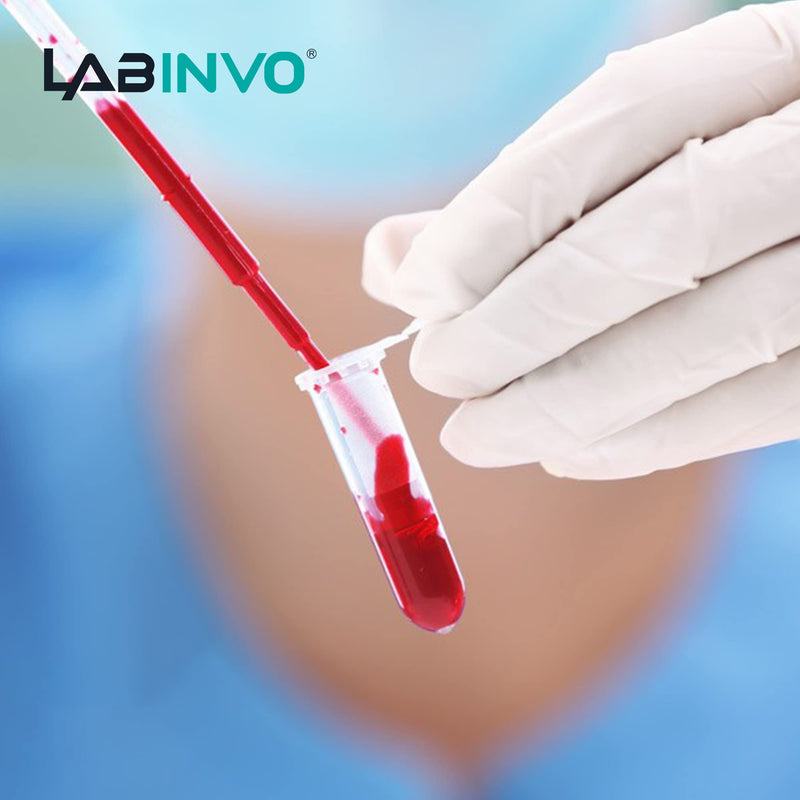 LABINVO 2ml Micro-Centrifuge Tube with Safe-Lock Cap, Frosted Writing Area, Round Bottom, PP Material, Molded Graduation10.3x40.5mm, Pack of 500, IN-MT20N Vol.2ml,500 pcs