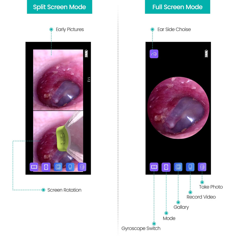 Wireless Otoscope Ear Camera with Dual View, 3.9mm 720PHD WiFi Ear Scope with 6 LED Lights for Kids and Adults, Compatible with Android and iPhone