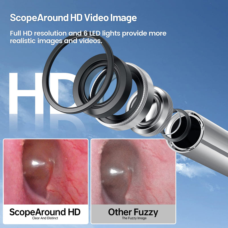 ScopeAround Ear Camera,Digital Otoscope with Light, Ear Endoscope and Ear Wax Remover, Video Ear Scope with Ear Wax Removal Tool, USB Ear Cleaning Camera for iPhone, Android &Tablet and PC.