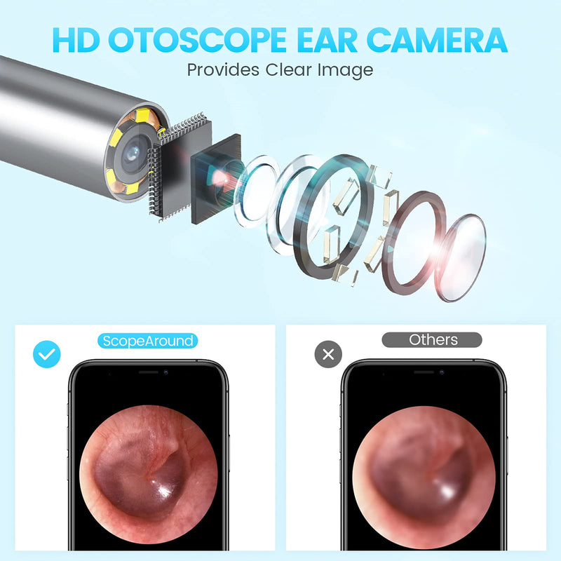 ScopeAround Ear Wax Removal Endoscope Earwax Remover Tool Ear Camera 720P HD Wireless Ear Otoscope with 6 LED Lights,Ear Scope with Ear Wax Cleaner Tool for Android Phone PC Tablet Not iPhone and iPad