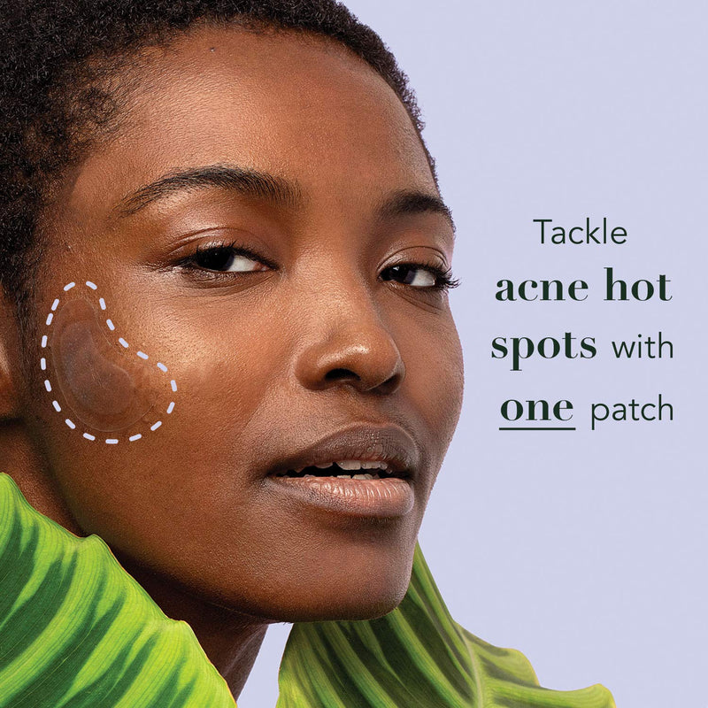 Rael Acne Pimple Healing Patch - Large Spot Control Cover, Long Size, Extra Coverage Acne Patch (10 Count)
