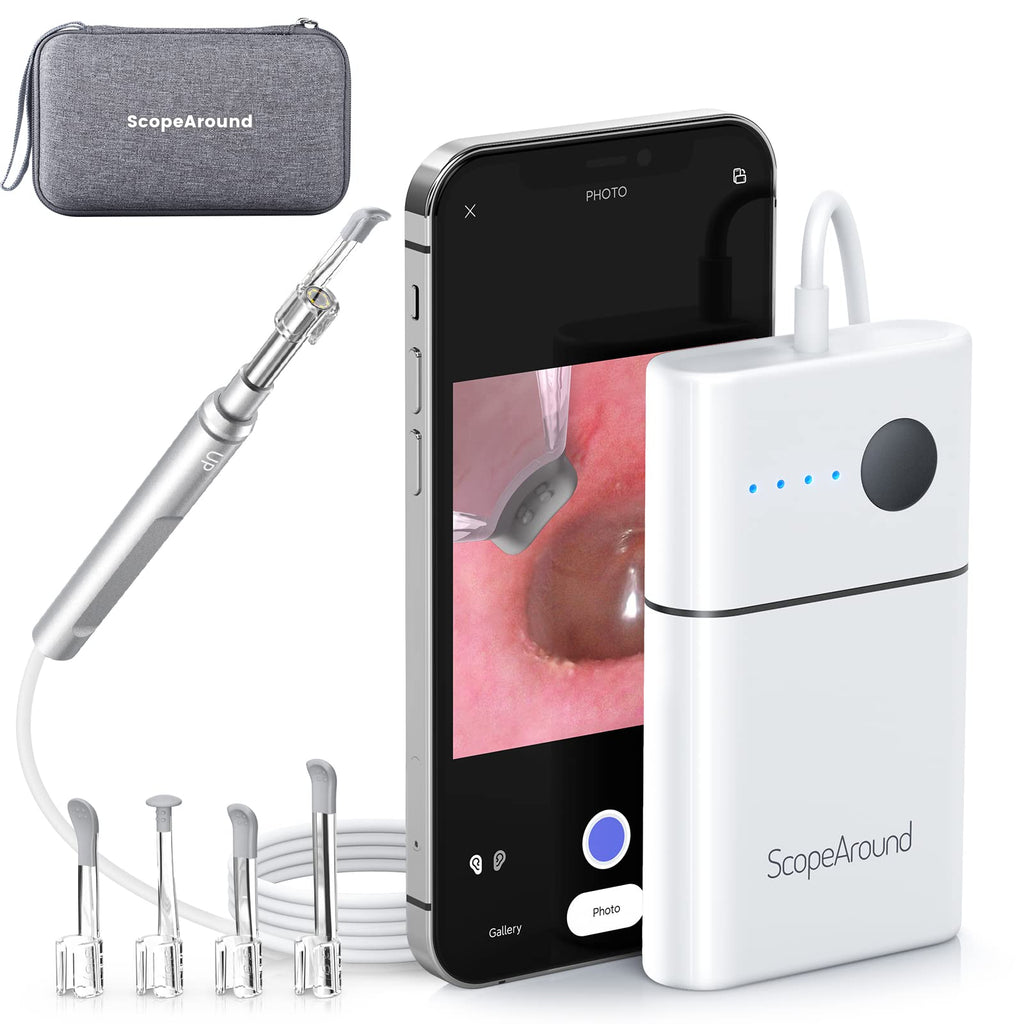 ScopeAround Ear Camera,Digital Otoscope with Light, Ear Endoscope and Ear Wax Remover, Video Ear Scope with Ear Wax Removal Tool, USB Ear Cleaning Camera for iPhone, Android &Tablet and PC.
